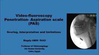 Rating severity of Aspiration on Videofluoroscopy PAS Scale [upl. by Auhsohey10]