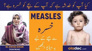 Khasra ki Alamat  Measles rubeola Symptoms and Treatment  Khasra Ka Ilaj [upl. by Hadwin]