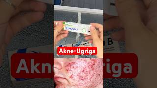 Ugri dog’laga qarshi uy sharoitida davolash skincare skincareroutine uzbekchastrim beauty [upl. by Shelman]