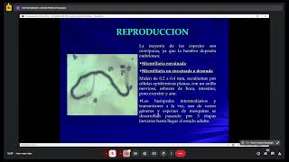 Parasitismo por nematodos filarias [upl. by Sualokin]