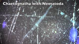 Chaetognatha with Nematoda [upl. by Ahsiem]