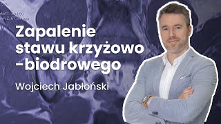 Zapalenie stawu krzyżowobiodrowego  16 Radiologia [upl. by Farrison928]