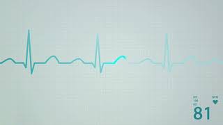 Decode WPW Syndrome Mastering ECG Delta Waves [upl. by Eidnak]