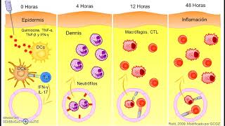 Leishmaniasis visceral  Diagnóstico [upl. by Addison]