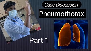 Pneumothorax Case Discussion part 1 [upl. by Lorita]