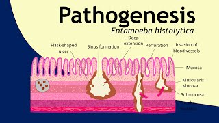 Pathogenesis of Entamoeba histolytica  parasitology  Basic Science Series [upl. by Aneert433]