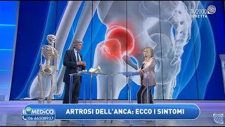 Artrosi allanca i sintomi come riconoscerla Le nuove protesi [upl. by Eico861]