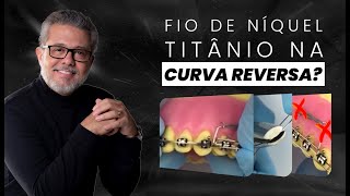 Curva reversa com fio de níquel titânio 🤔 [upl. by Eniamor]