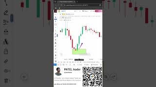 Best entry point in trading chartanalysis trading stockmarket pateltrade shorts [upl. by Ingraham297]