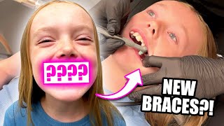 Kalia Gets Braces For The First Time SCARY [upl. by Mattox]