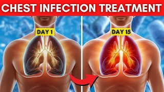 7 Natural Chest Infection Treatments Home Remedies [upl. by Ailadi159]