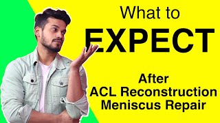 Expectations after ACL Reconstruction and Meniscus Repair [upl. by Ahsyia]