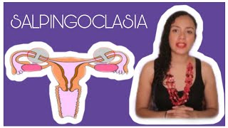 SALPINGOCLASIA ESTERILIZACIÓN FEMENINA OTB CUIDADOS ¿ES REVERSIBLE 🤰 [upl. by Andrea]