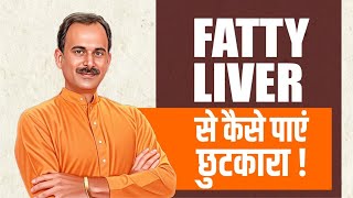 How to Cure Fatty Liver Naturally  Main Causes of Fatty Liver  Ayurvedic Tips  Shuddhi Ayurveda [upl. by Allan]