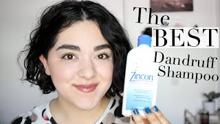 The Best Dandruff Shampoo  Beauty Bite [upl. by Yerga]