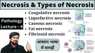 Necrosis and Types of Necrosis in Hindi Pathology Lecture Notes Bsc Nursing GNM MLT Pharmacy [upl. by Yamauchi]