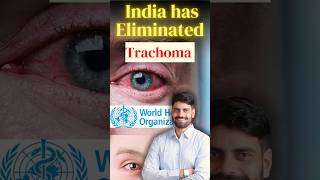 India Has Eliminated Trachoma currentaffairs2024 Trachoma disease currentgk kumaredutainment [upl. by Clementius]