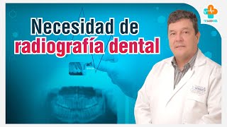 Necesidad de Radiografía Dental  Tu Salud Guía [upl. by Ravilob]