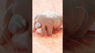 What is scabies  shorts  skin care  skin infection  Sarcoptes scabiei [upl. by Arndt758]