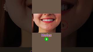 How to manage moles amp open pore Skin Care Tips  Dr Sarin [upl. by Yekcim]