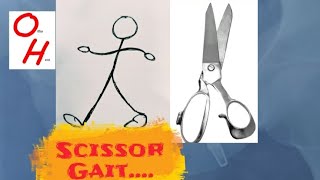 Scissor Gait [upl. by Adnih120]