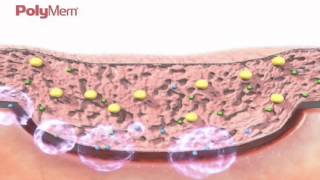 PolyMem What is a polymeric membrane dressing [upl. by Sieracki159]