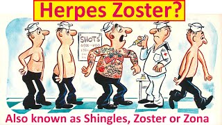 What is Herpes Zoster [upl. by Zurciram]