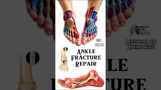 Tibial Nail System—Standard Surgical Technique [upl. by Britta]