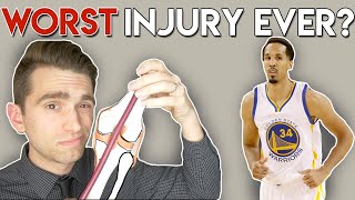 WORST NBA Injury EVER Doctor Explains Shaun Livingston Injury [upl. by Tillford623]