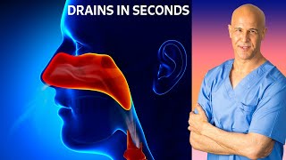 Dr Mandells Sinus Drainage Trick [upl. by Urina]