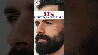 Ivory Natural  Grey Beard Serum  Reverse Premature Greying with Highly Potent Serum serum shorts [upl. by Alohcin]