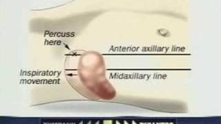 Examination of the Spleen [upl. by Aric]