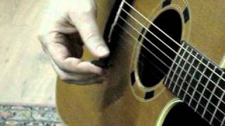 6Guitarist and hand dystonia difficulty holding the plectrum [upl. by Martino]