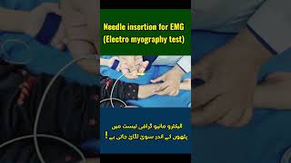 EMG Needle Insertion A Patients Guide  What to Expect [upl. by Dove]