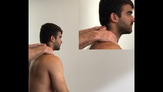 Massage technique for neck pain [upl. by Latsyek]