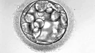 Development of hatching Embryo blastocyst stage [upl. by Minni]