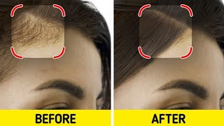 Hair Fall SOLUTION At Home 😱 hairfallsolution [upl. by Alauqahs]