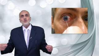 Elbromboly Basic ophthalmology IC Conjunctiva Allergic conjunctivitis [upl. by Aihsotal]