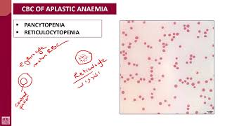 Hematology  1  U9L4  CBC [upl. by Gierc942]