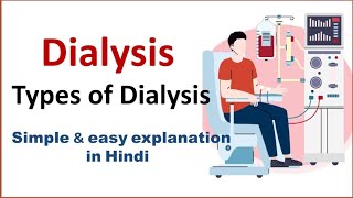 Dialysis  Types of Dialysis  Hemodialysis  Peritoneal dialysis  NEET [upl. by Lorin]