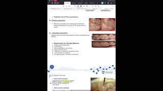 Paediatric dentistry 1  Fissure sealants in comprehensive way [upl. by Ahsie291]