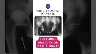 Which ligament prevents the posterior dislocation of hip joint shorts hipjoint ligaments [upl. by Noorah424]