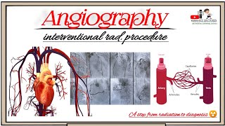 Angiography ArteriographyVenography Angiography radiological examination Angiography test [upl. by Hgielyk]