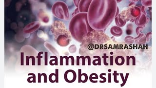 Inflammation and Obesity [upl. by Niveek306]