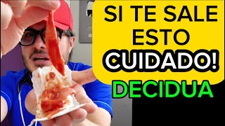 Endometriosis síntomas y tratamiento  Reacción Decidual Endometrial [upl. by Alejo735]