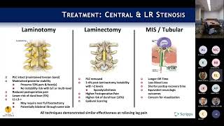 Neurogenic Claudication amp Lateral Recess Stenosis  Rick Lang MD on August 15 2022 [upl. by Torre876]