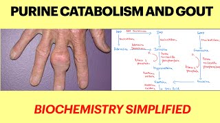 Purine catabolism and Gout  purine degradation pathway Gout biochemistry Purine metabolism  MBBS [upl. by Idisahc672]