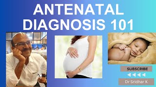 Antenatal diagnosis 101 I NIPT I Down syndrome trisomy nipt [upl. by Riehl]