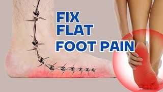 How To Fix Flat Foot Pain INSTANTLY [upl. by Niall]