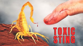 STUNG by the DEADLIEST Scorpion in America [upl. by Assiled]